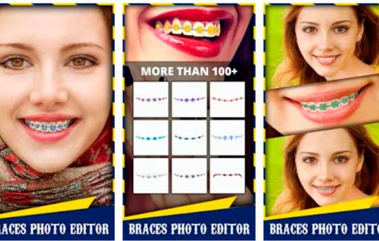 aparelho dentário virtual