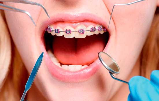 aparelho odontológico grátis