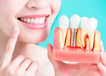 implante dentário grátis