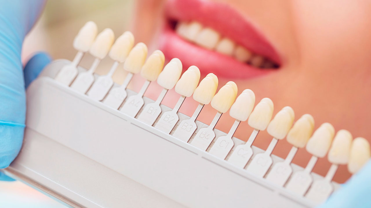 implante dentário grátis pelo SUS