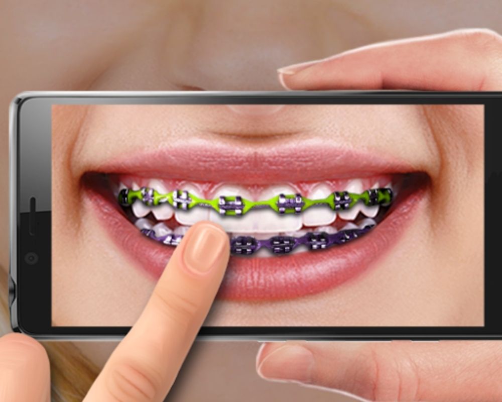 Colocar aparelho dentário em fotos